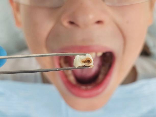 Best Emergency Dental Care for Trauma or Injury in Washington, WV